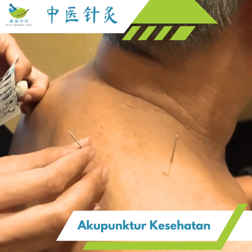 akupuntur kesehatan
