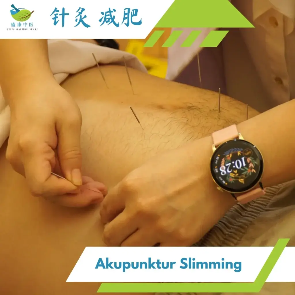 akupuntur slimming